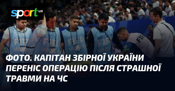 Зображення. Капітан української збірної переніс хірургічне втручання після жахливої травми, отриманої на чемпіонаті світу.